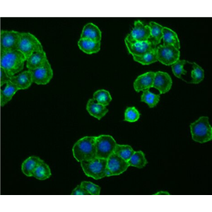 NCI-H441 人肺腺癌细胞