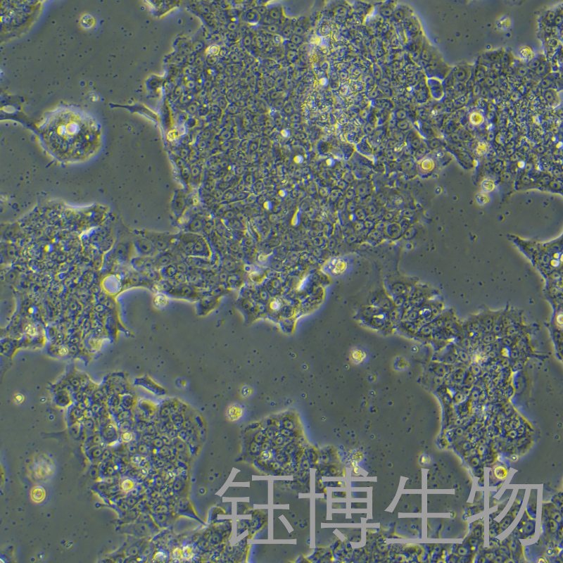 NCI-H1435（人肺腺癌细胞）YB-75829HC,NCI-H1435