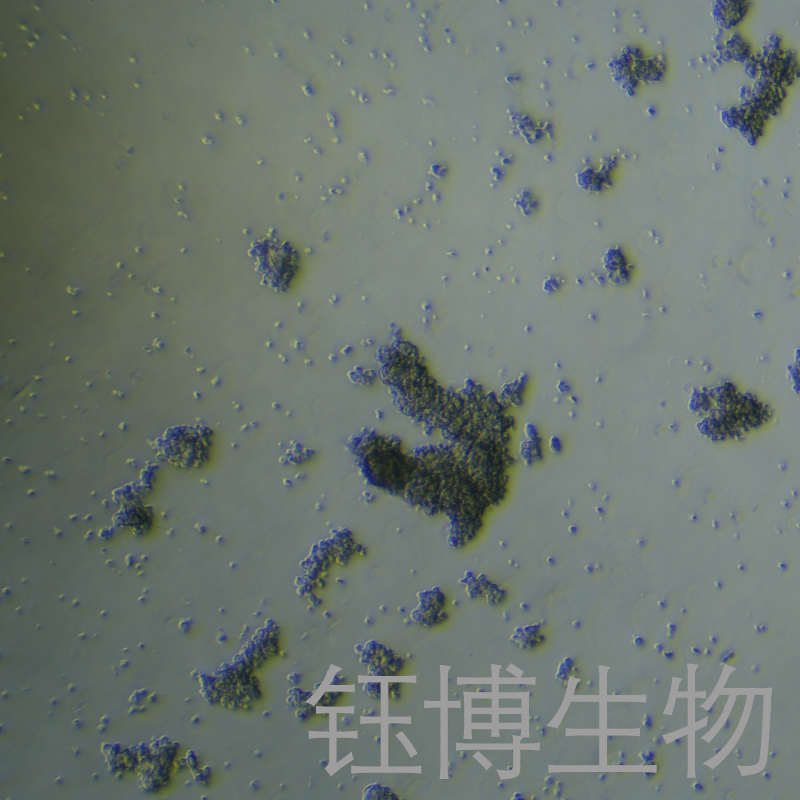 NCI-H1836（小细胞肺癌细胞）YB-75834HC,NCI-H1836