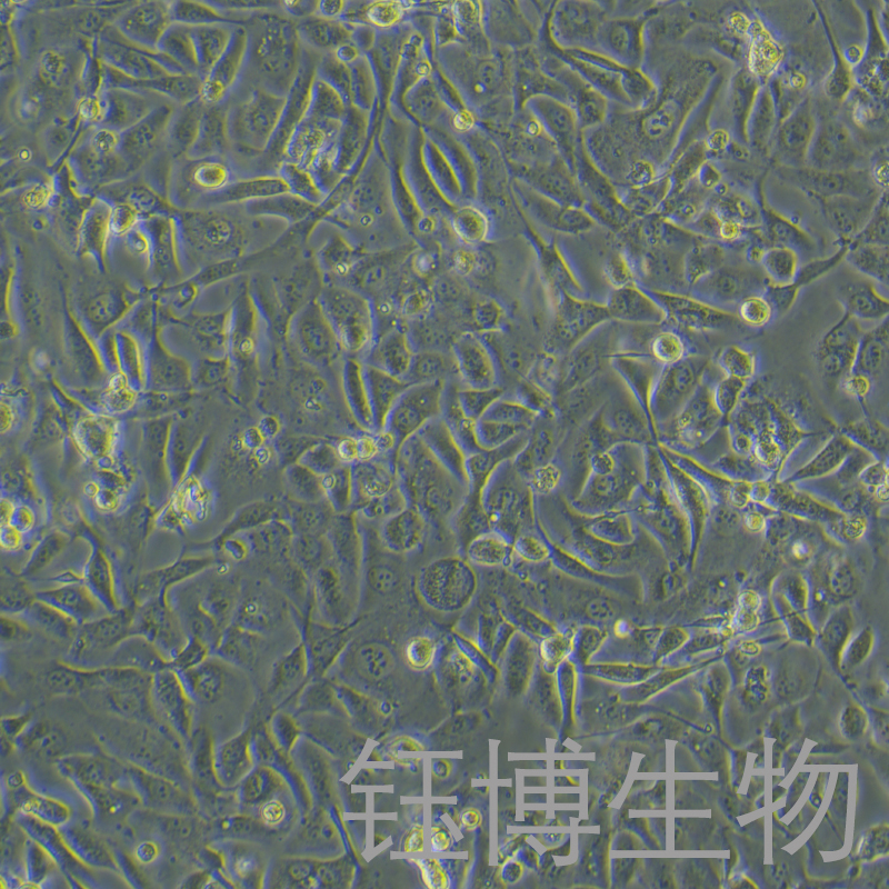 OV56（浆液性卵巢腺癌细胞）YB-75848HC,OV56