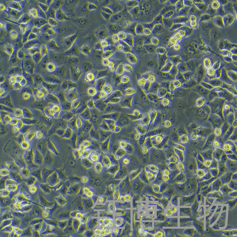 PANC-1-LUC-eGFP-Puro（人胰腺癌细胞-绿色荧光蛋白-荧光素酶标记）YB-71184HC-LGP,PANC-1-LUC-eGFP-Puro