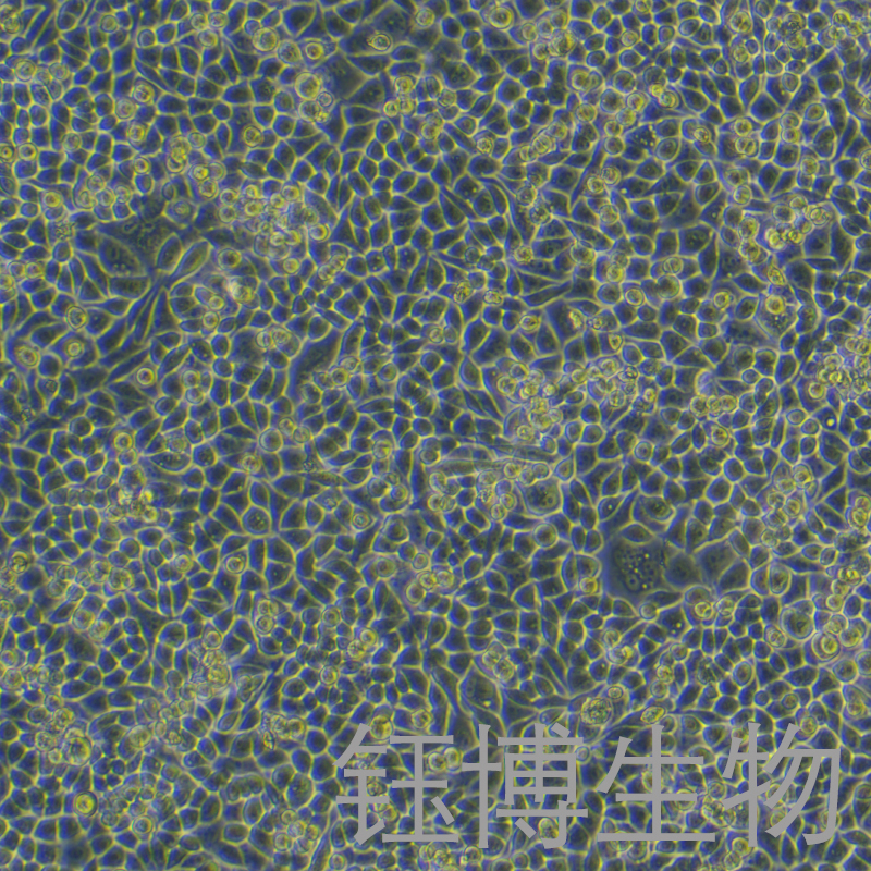 PC-9-LUC（人肺腺癌细胞带荧光素酶）YB-71668HC-L,PC-9-LUC