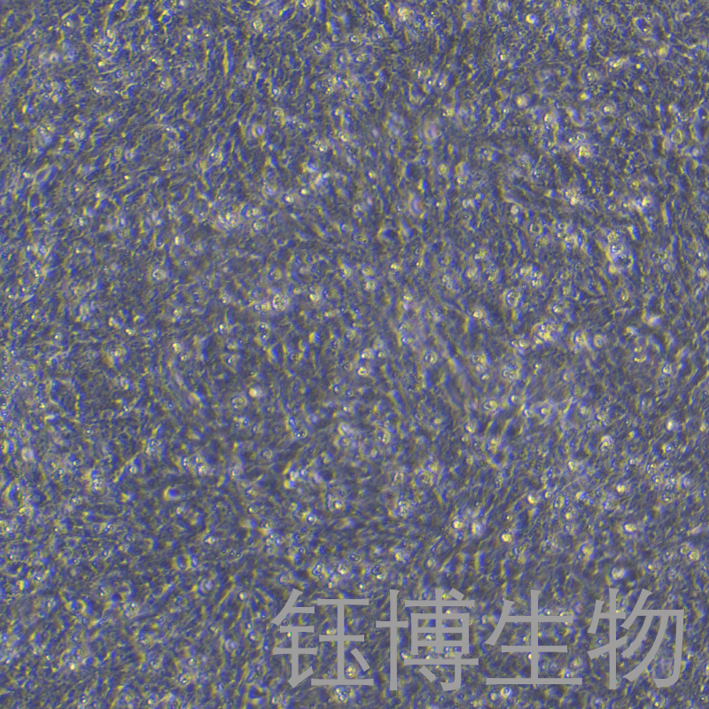 R28（大鼠视网膜前体细胞）YB-75862RC,R28