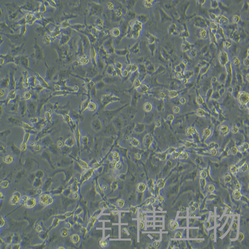 RD-ES（人尤文氏肉瘤）YB-75865HC,RD-ES