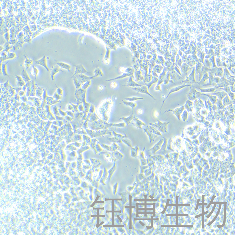 SK-ES-1（尤因肉瘤）YB-75874HC,SK-ES-1