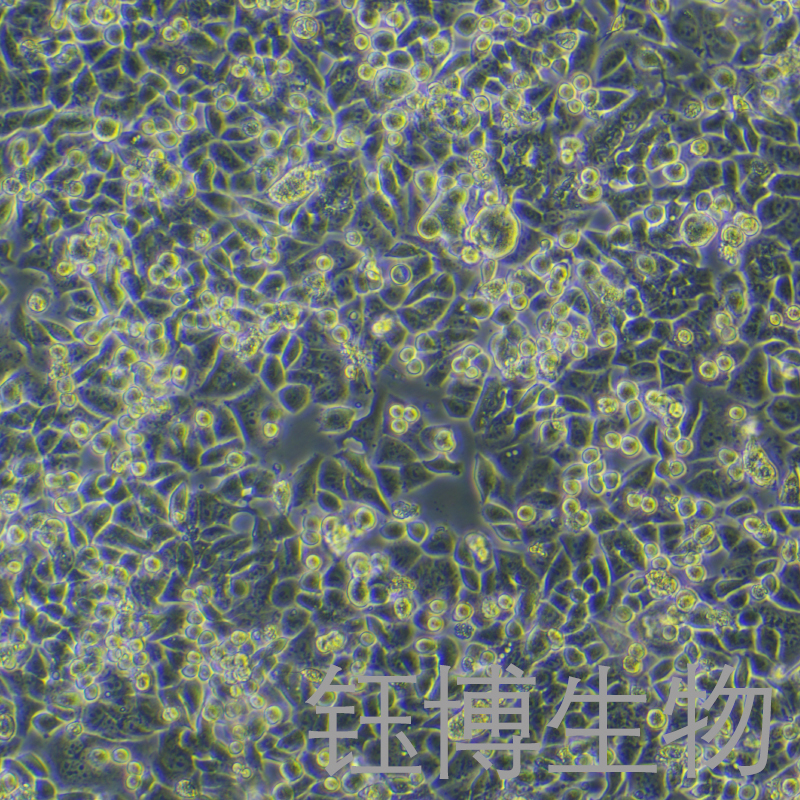 SK-BR-3-LUC（人乳腺癌细胞-荧光素酶标记）YB-71211HC-L,SK-BR-3-LUC