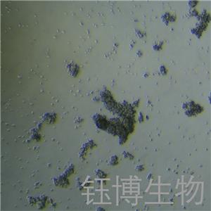 NCI-H1836（小细胞肺癌细胞）YB-75834HC,NCI-H1836