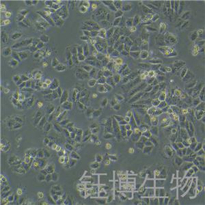 NCI-H460/cis（人大细胞肺癌顺铂耐药株）YB-71299HCR,NCI-H460/cis