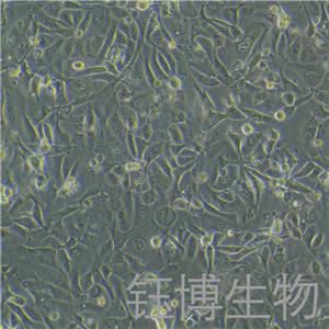 OV56（浆液性卵巢腺癌细胞）YB-75848HC