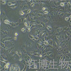 OVISE（人卵巢癌细胞）YB-75849HC