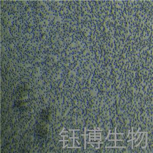 PBMC（人原代外周血单个核细胞）YB-75854HC