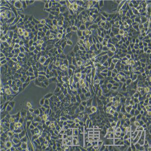 PIG1（正常人皮肤黑色素细胞）YB-75857HC