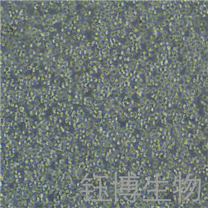 Raji-eGFP-luc（人口腔鳞癌细胞-荧光素酶标记+绿色荧光蛋白）YB-71189HC-LG