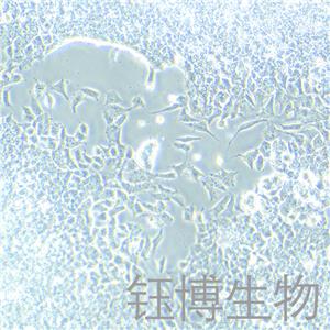 SK-ES-1（尤因肉瘤）YB-75874HC