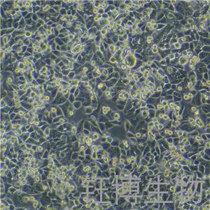 SK-BR-3-LUC（人乳腺癌细胞-荧光素酶标记）YB-71211HC-L,SK-BR-3-LUC