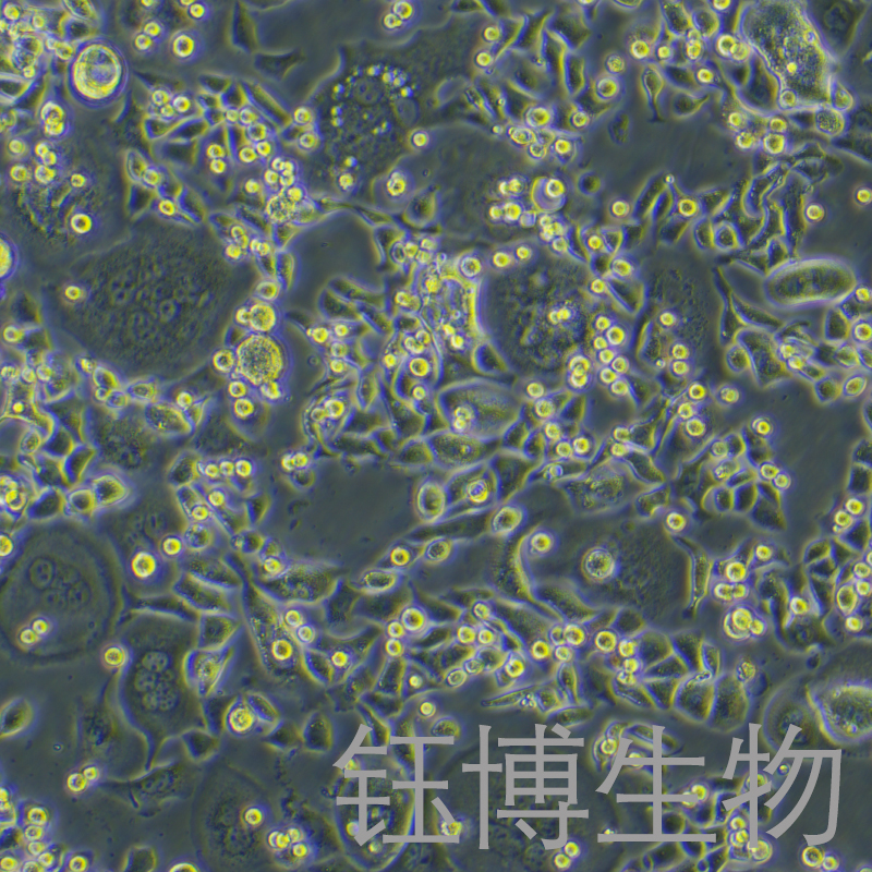 SNU-C2A（人结肠癌细胞）YB-75883HC,SNU-C2A