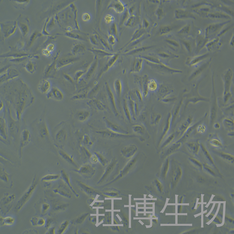 SSP-25（人肝胆管癌细胞）YB-75885HC,SSP-25