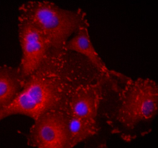 小鼠肝星状细胞,Mouse hepatic stellate cells