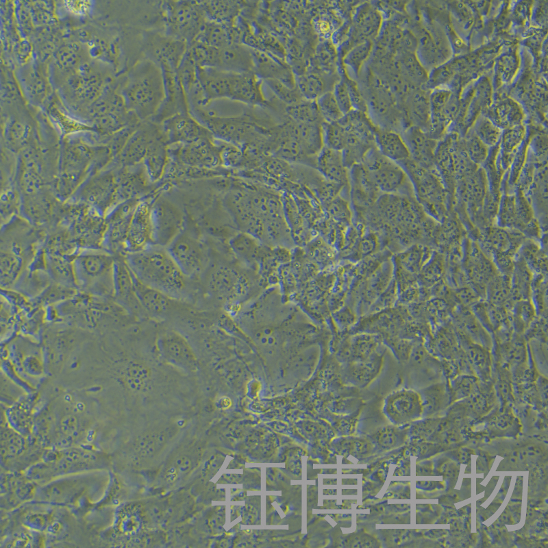 Tramp-C1（小鼠前列腺癌上皮细胞）YB-75897MC,Tramp-C1