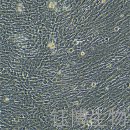 人瘢痕疙瘩成纤维细胞永生化 YB-75919HIC,Immortalization of human keloid fibroblasts
