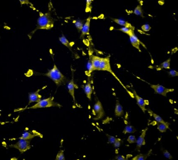 人膀胱移行上皮细胞,Human Trabecular Cells
