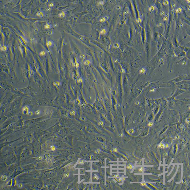 人骨骼肌细胞永生化 YB-7086HIC,Immortalization of human skeletal muscle cells