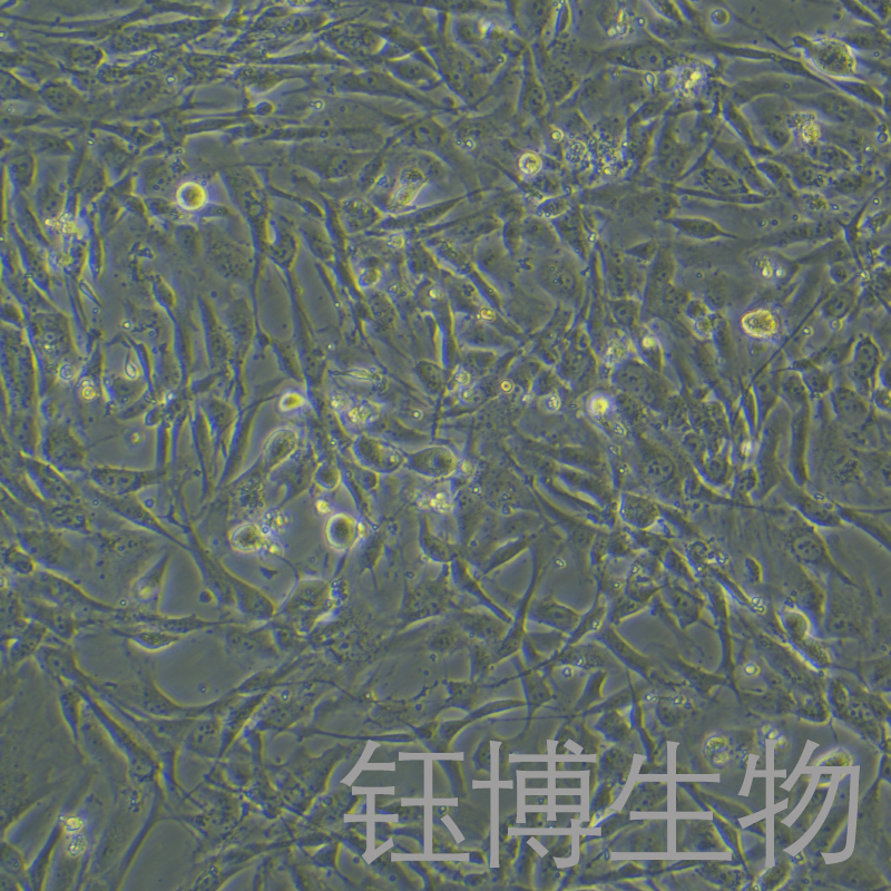 人乳腺癌成纤维细胞永生化 YB-7155HIC,Immortalization of fibroblasts in human breast cancer
