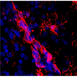 RKO-AS45-1 人结肠癌转基因细胞