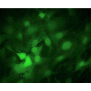 人胰腺星状细胞