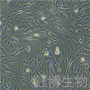 人成骨细胞永生化 YB-7097HIC