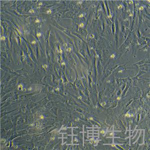 人骨骼肌细胞永生化 YB-7086HIC