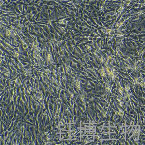 人甲状旁腺细胞永生化 YB-75926HIC