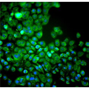 人角膜内皮细胞,Human corneal endothelial cells