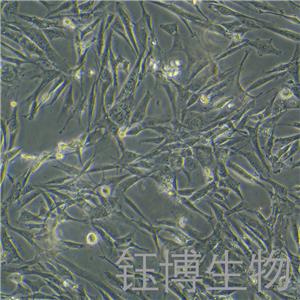 人软骨细胞永生化 YB-7093HIC