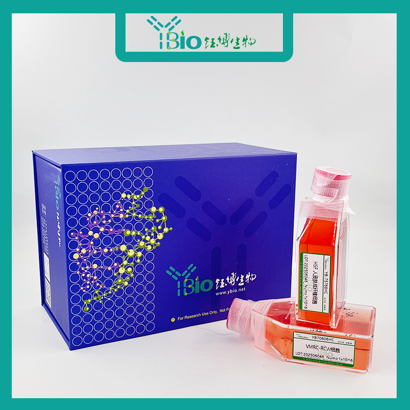 人乳腺上皮细胞永生化 YB-7016HIC,Immortalization of human breast epithelial cells