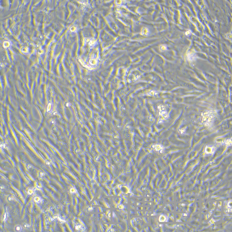 人胰腺癌细胞永生化 YB-75931HIC,Immortalization of human pancreatic cancer cells