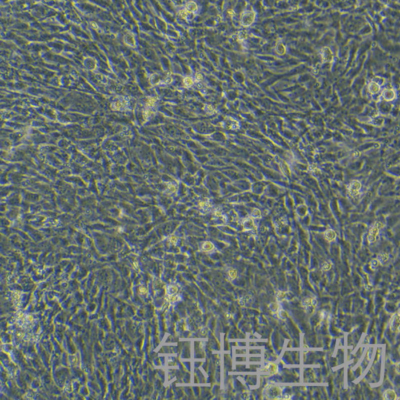人胰腺癌相关成纤维细胞永生化 YB-75932HIC,Immortalization of fibroblasts associated with human pancreatic cancer