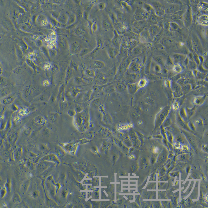 人子宫内膜上皮细胞永生化 YB-7053HIC,Immortalization of human endometrial epithelial cells