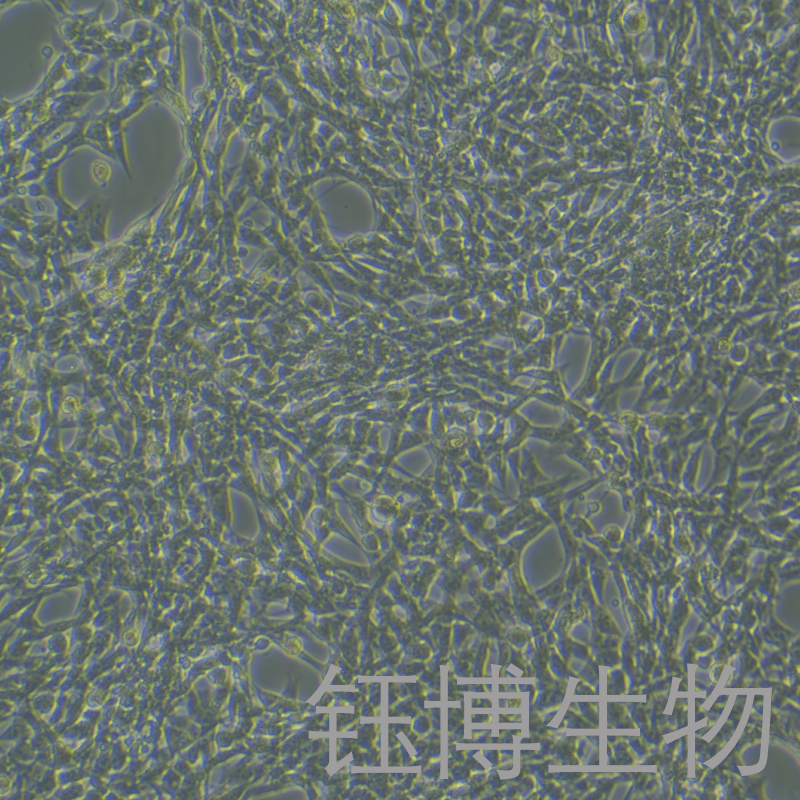 小鼠肝星状细胞永生化 YB-7039MIC,Immortalization of mouse liver stellate cells