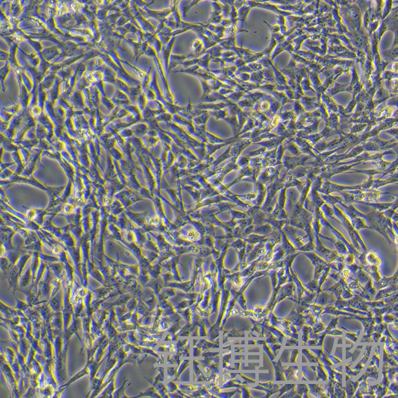 小鼠胰腺星状细胞永生化 YB-7015MIC,Immortalization of mouse pancreatic stellate cells