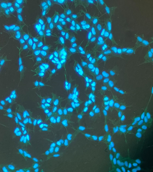 大鼠前列腺干细胞,Rat prostate stem cells