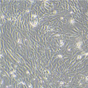 人胰腺癌细胞永生化 YB-75931HIC,Immortalization of human pancreatic cancer cells