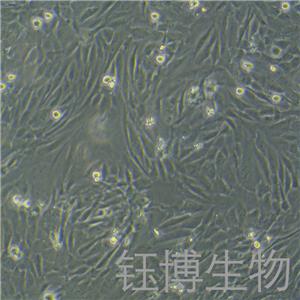 人支气管平滑肌细胞永生化 YB-7011HIC