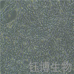 小鼠肝星状细胞永生化 YB-7039MIC