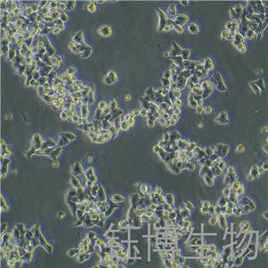 VMRC-LCD（人非小细胞肺癌细胞）YB-75960HC