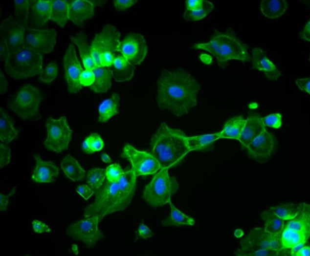 大鼠阴道壁成纤维细胞,Rat vaginal wall fibroblasts