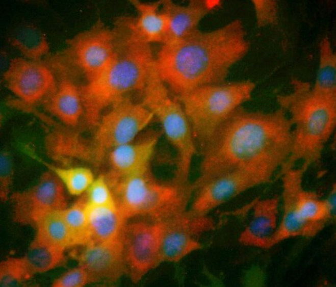 大鼠冠状动脉成纤维细胞,Rat coronary artery fibroblasts