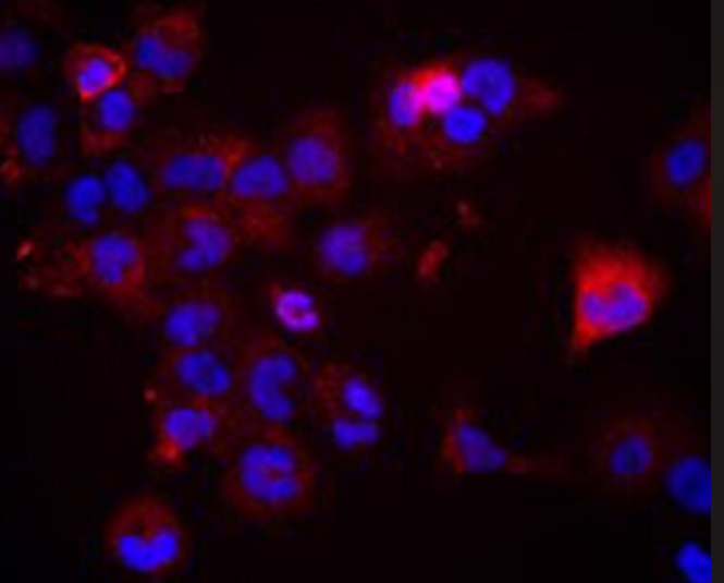 小鼠外周血树突状细胞成熟DC细胞,Mouse peripheral blood dendritic cells, mature DC cells