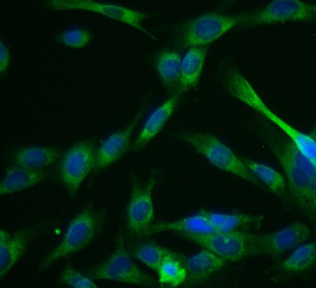 兔血管外膜成纤维细胞,Rabbit vascular outer membrane fibroblasts