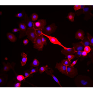 小鼠胰岛β细胞,Mouse pancreatic islet β cells